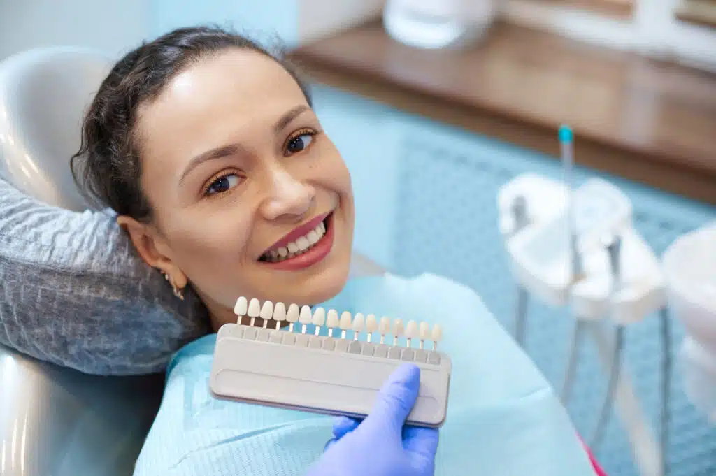 how long do veneers really last