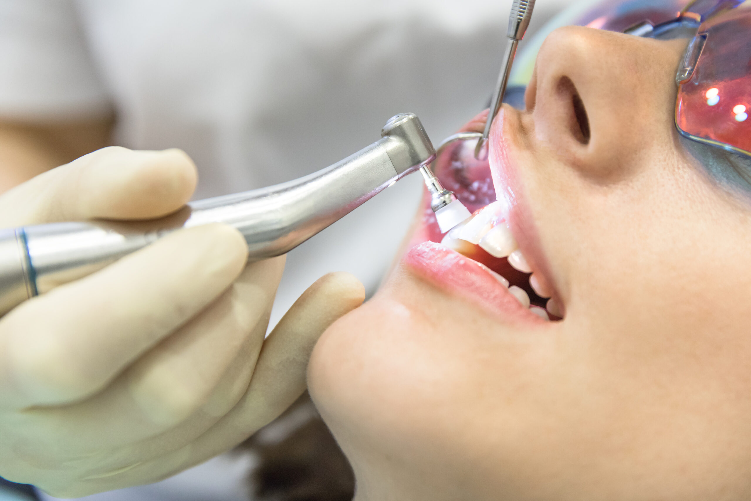The Truth About Teeth Whitening: Safety Myths vs. Facts