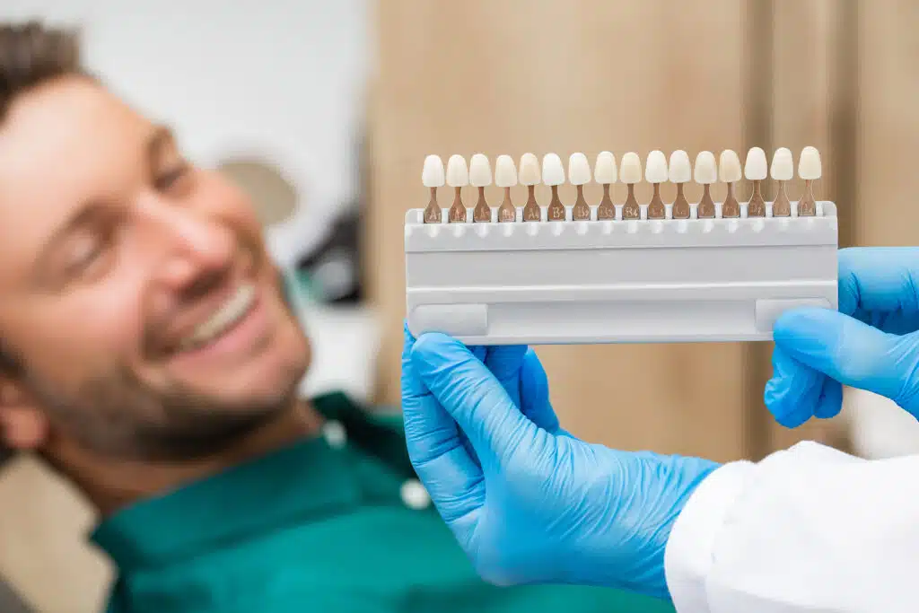 Palette Tooth Color Sample To Determine Shade Over Patients Teet