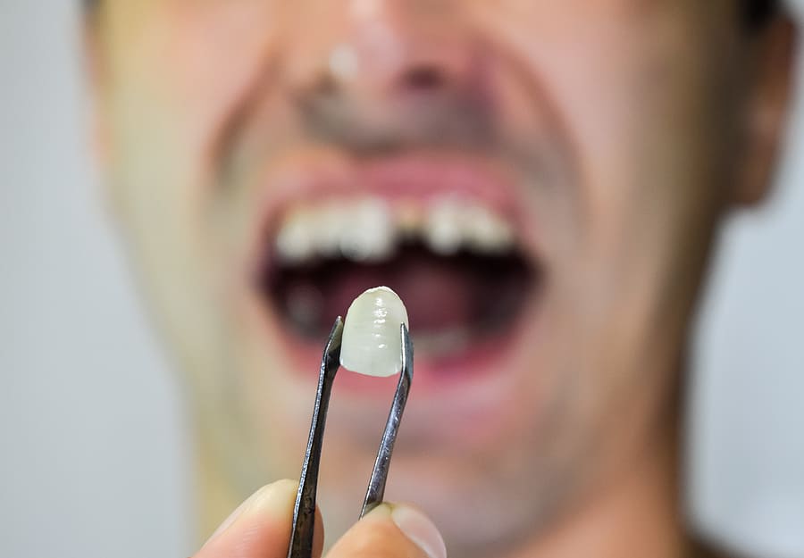 Comfortable denture consultation near Verplanck NY at Hudson Valley Dental Medicine