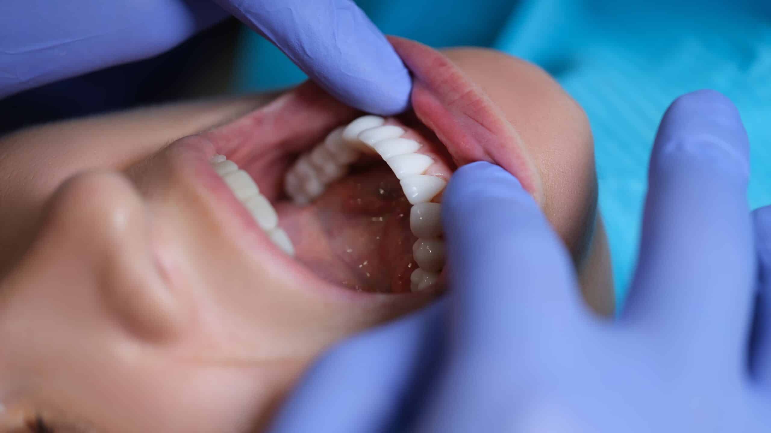 Smiling patient near Mohegan Lake NY after porcelain veneer consultation at Hudson Valley Dental Medicine